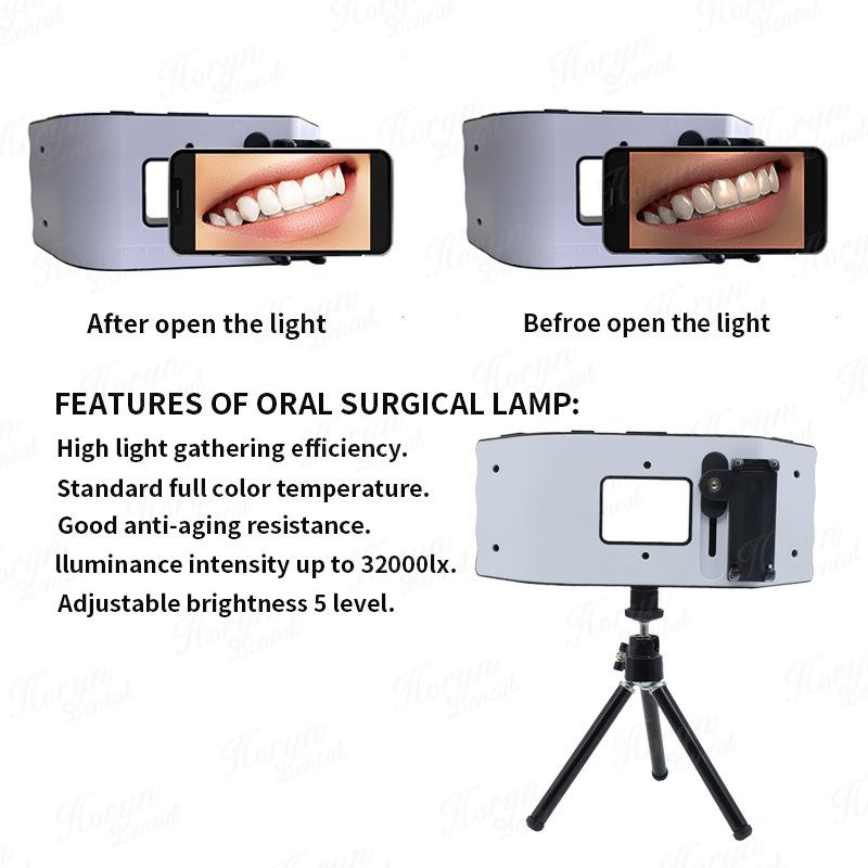 Dental Flash Light Photography - đánh giá và giá Photography Lighting With Flash